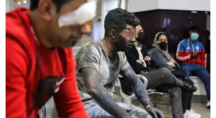 مصدومان حادثه چهارشنبهسوری در کرمانشاه به ۲۱۷نفر رسید